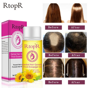 Liquid Herbal Hair Growth Prevents Hair Loss Rapid and Thick Growth Treatment Essential Oils for Health and Beauty Essence